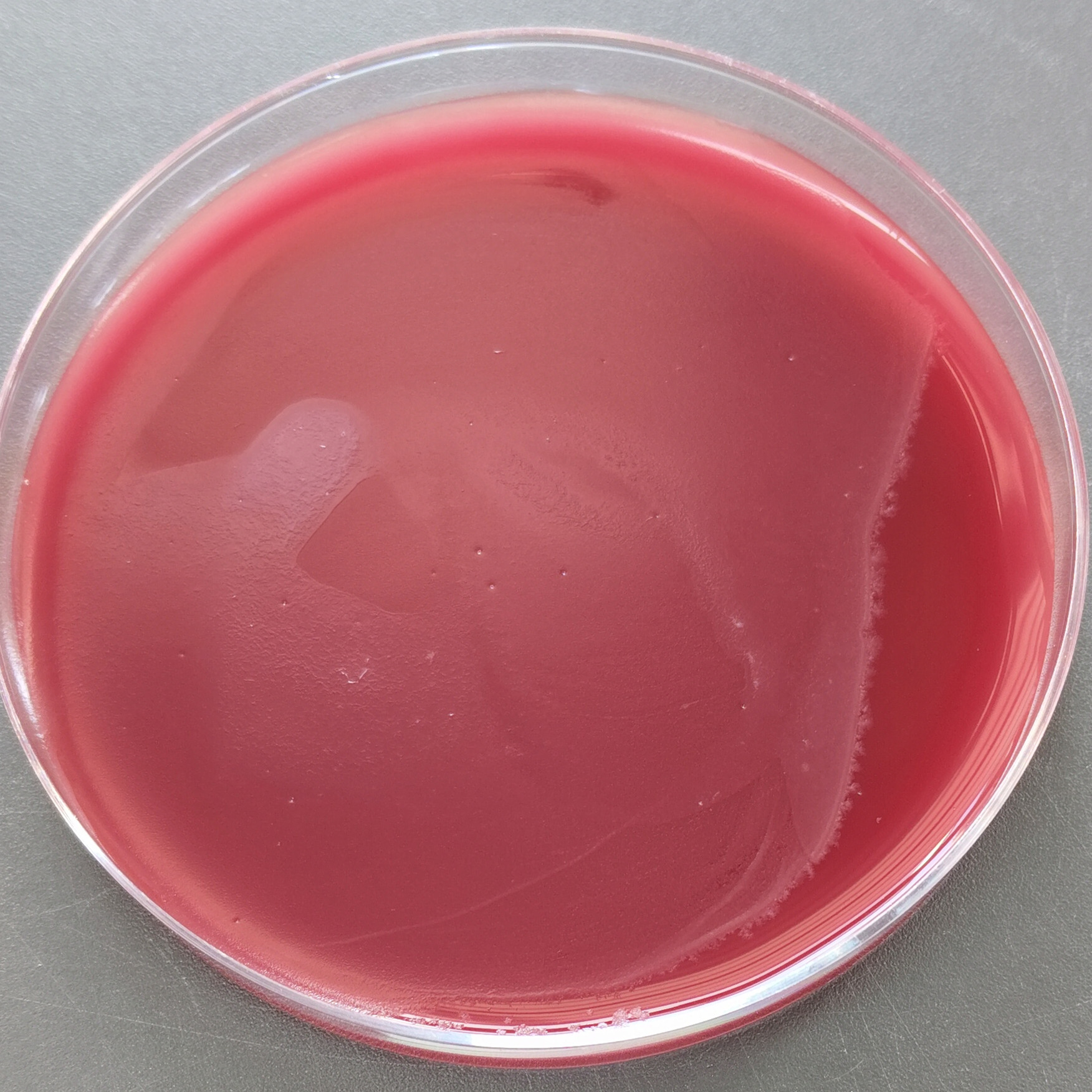 Clostridium difficile 1351-BNCC