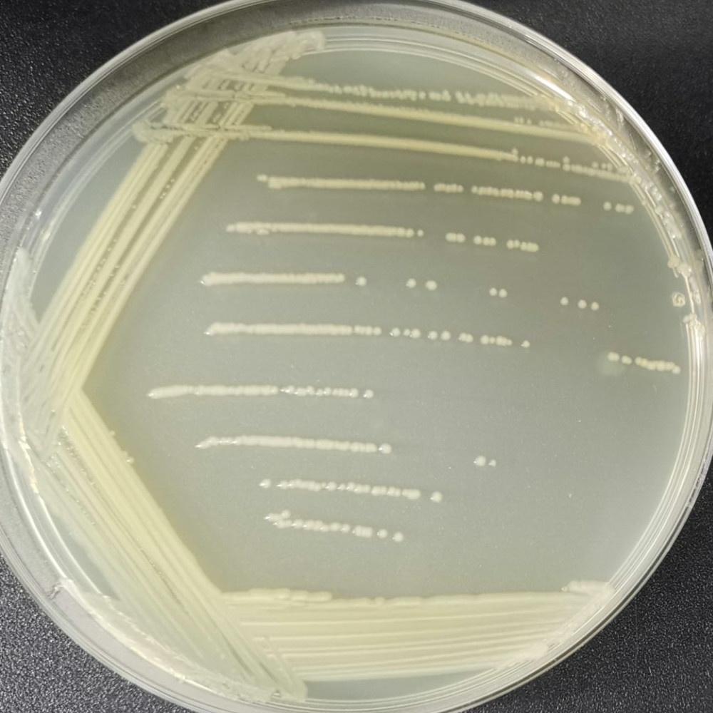 Salmonella Enteritidis subsp. Enteritidis Typhimurium Serotype-BNCC