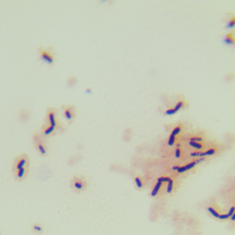 Bacillus thuringiensis-BNCC