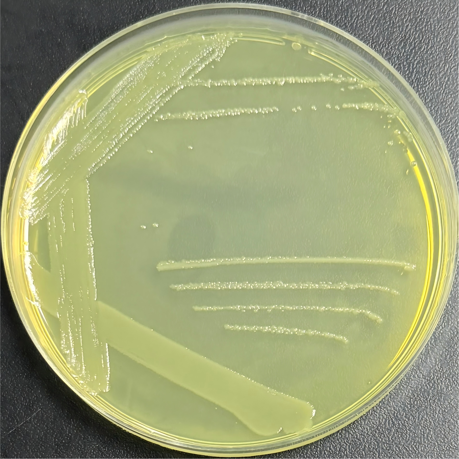 Escherichia coli-BNCC