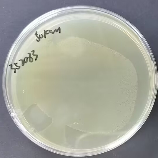 Escherichia coli-BNCC