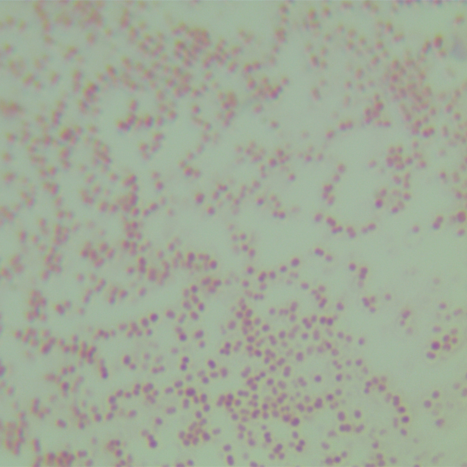 Neisseria meningitidis-BNCC