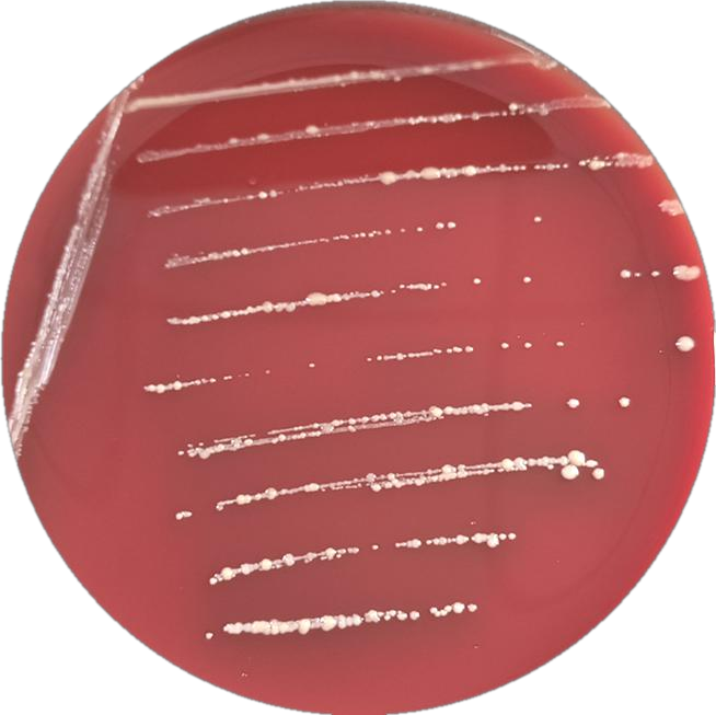 Propionibacterium fischeri subsp. Xie-BNCC