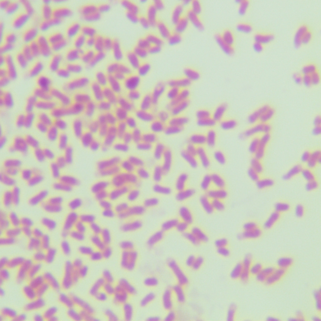 Pseudomonas aeruginosa-BNCC