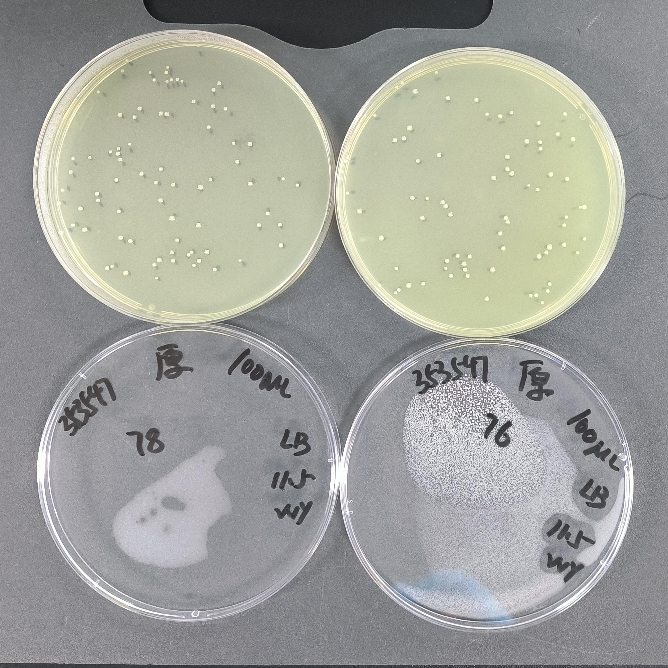 Quantitative strain of Salmonella typhimurium in colitis mice-BNCC
