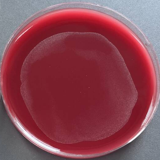 Alistipes indistinctus-BNCC