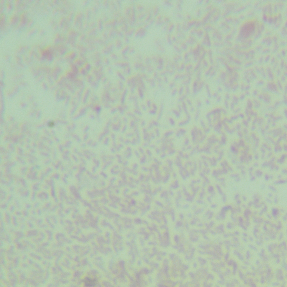 Alistipes indistinctus-BNCC
