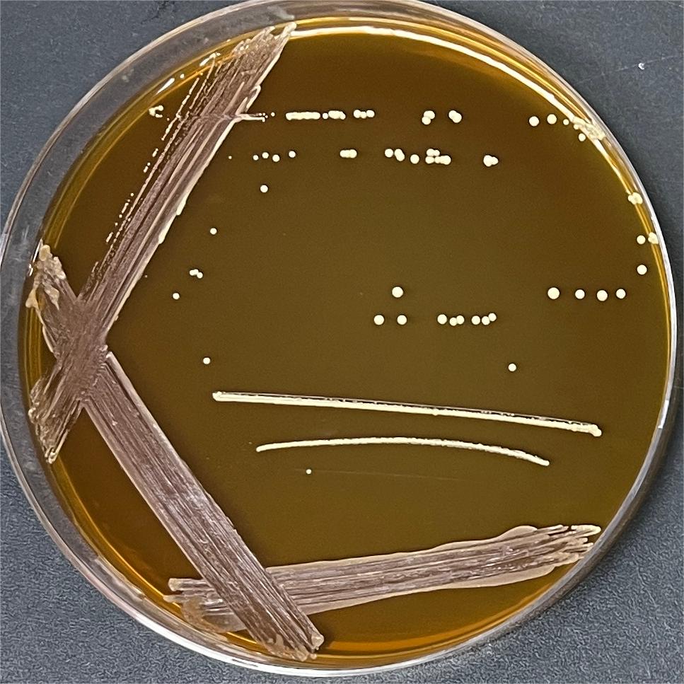 Lactobacillus plantarum-BNCC