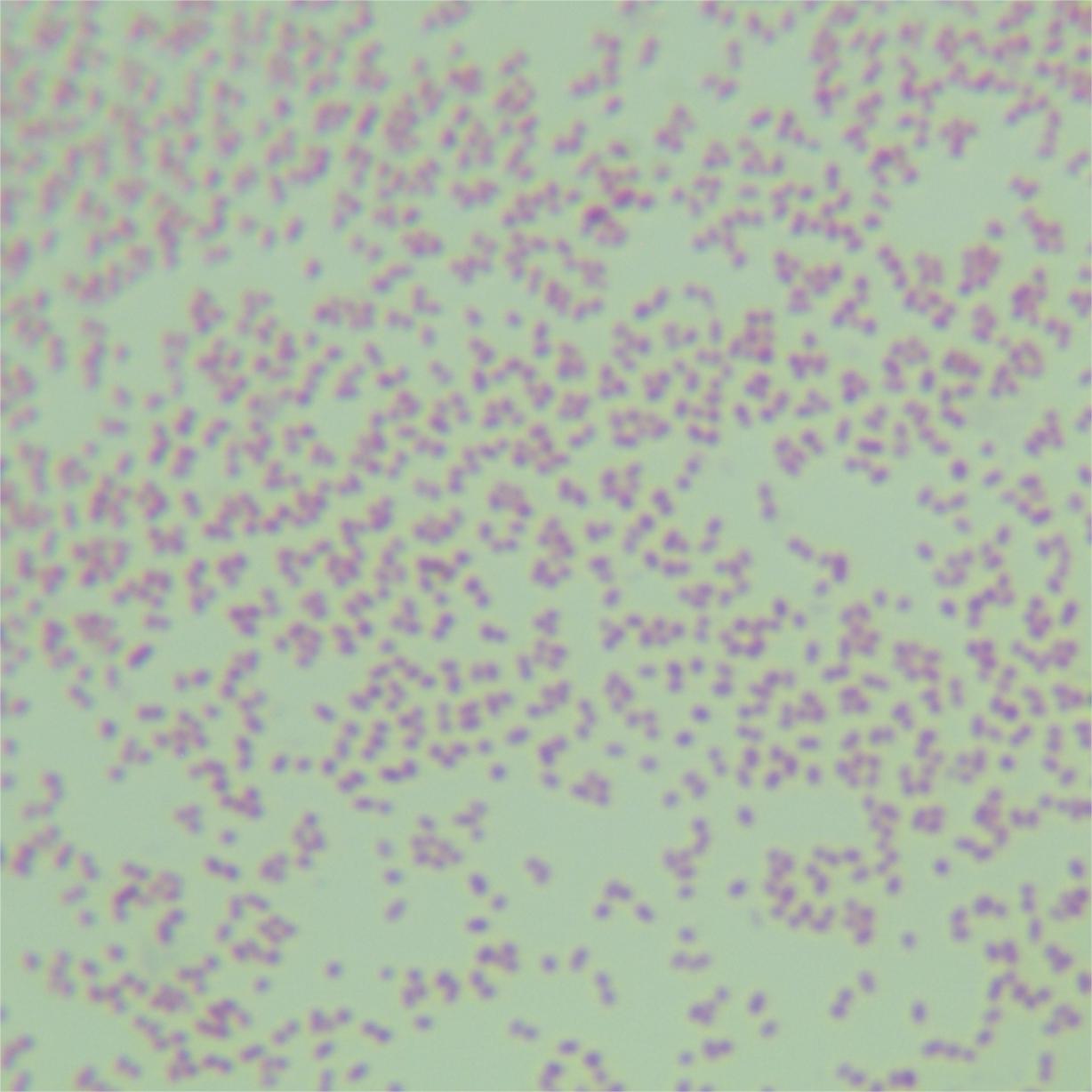 Bordetella pertussis-BNCC