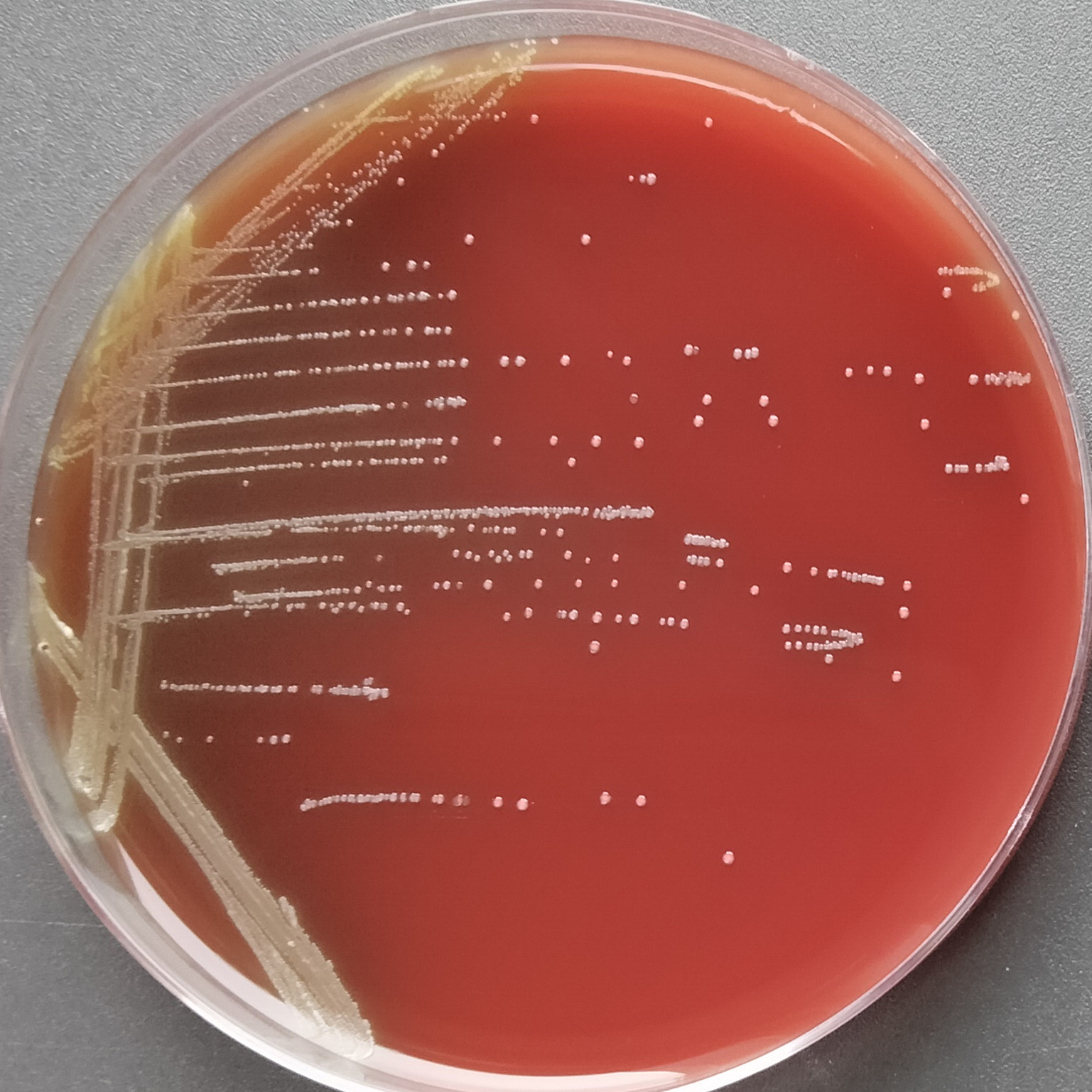 Streptococcus pyogenes A-BNCC