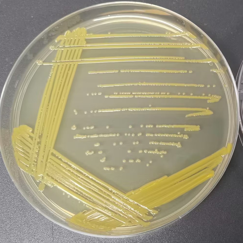 Lactobacillus casei-BNCC