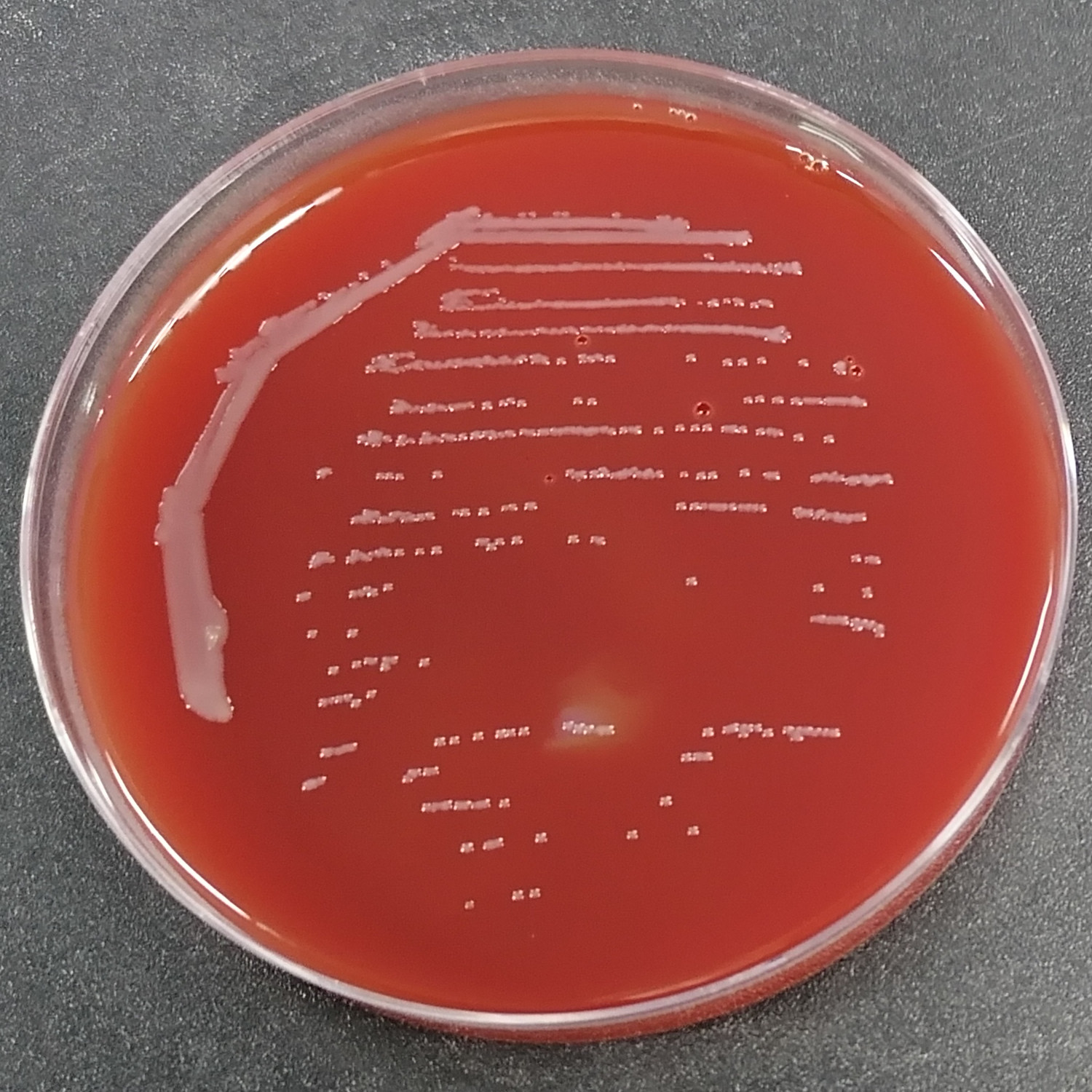 Neisseria meningitidis-BNCC