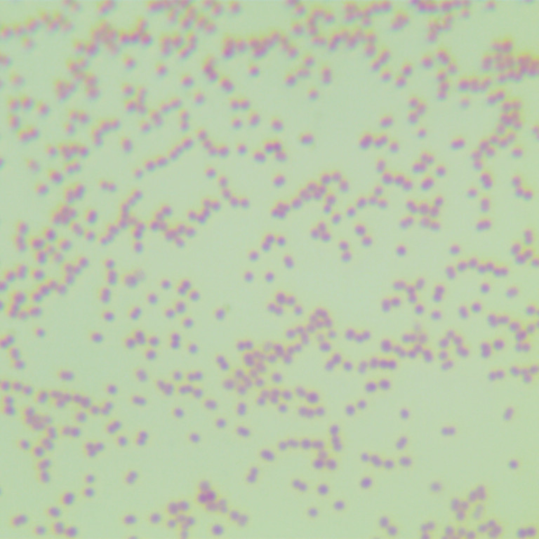 Neisseria meningitidis-BNCC