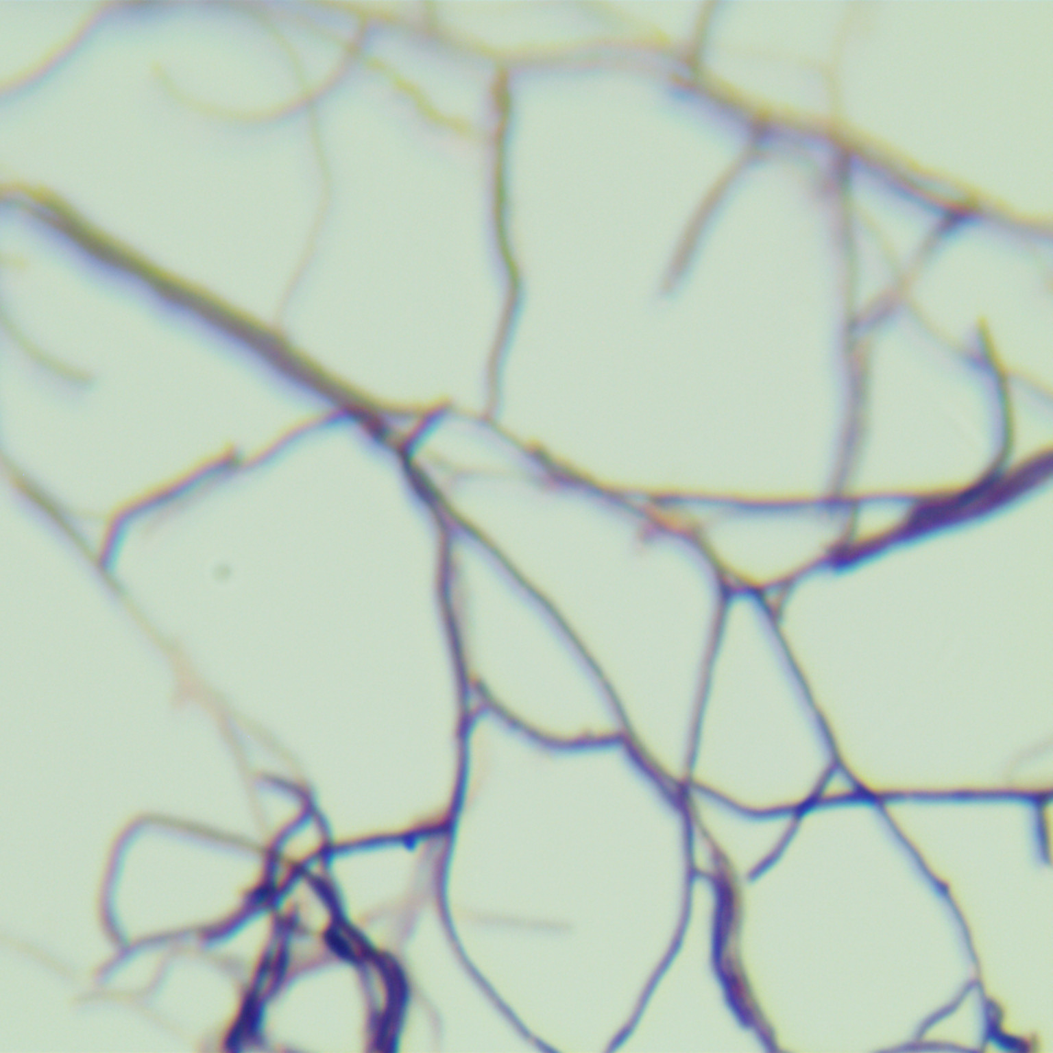 Brown thermophilic fungus-BNCC