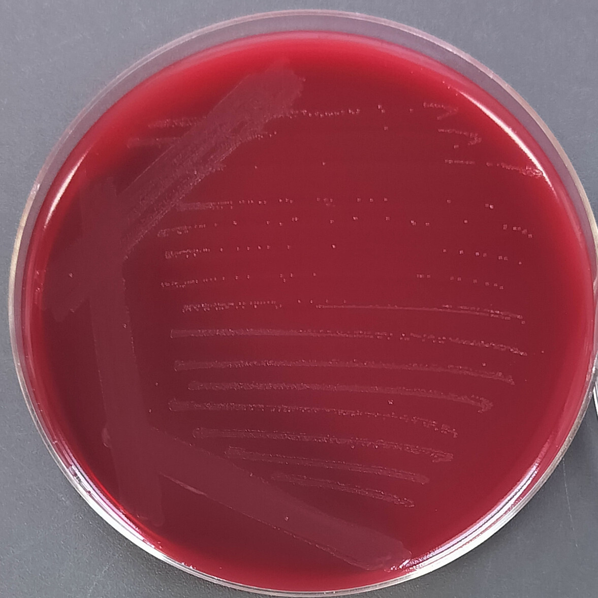 Alistipes senegalensis-BNCC