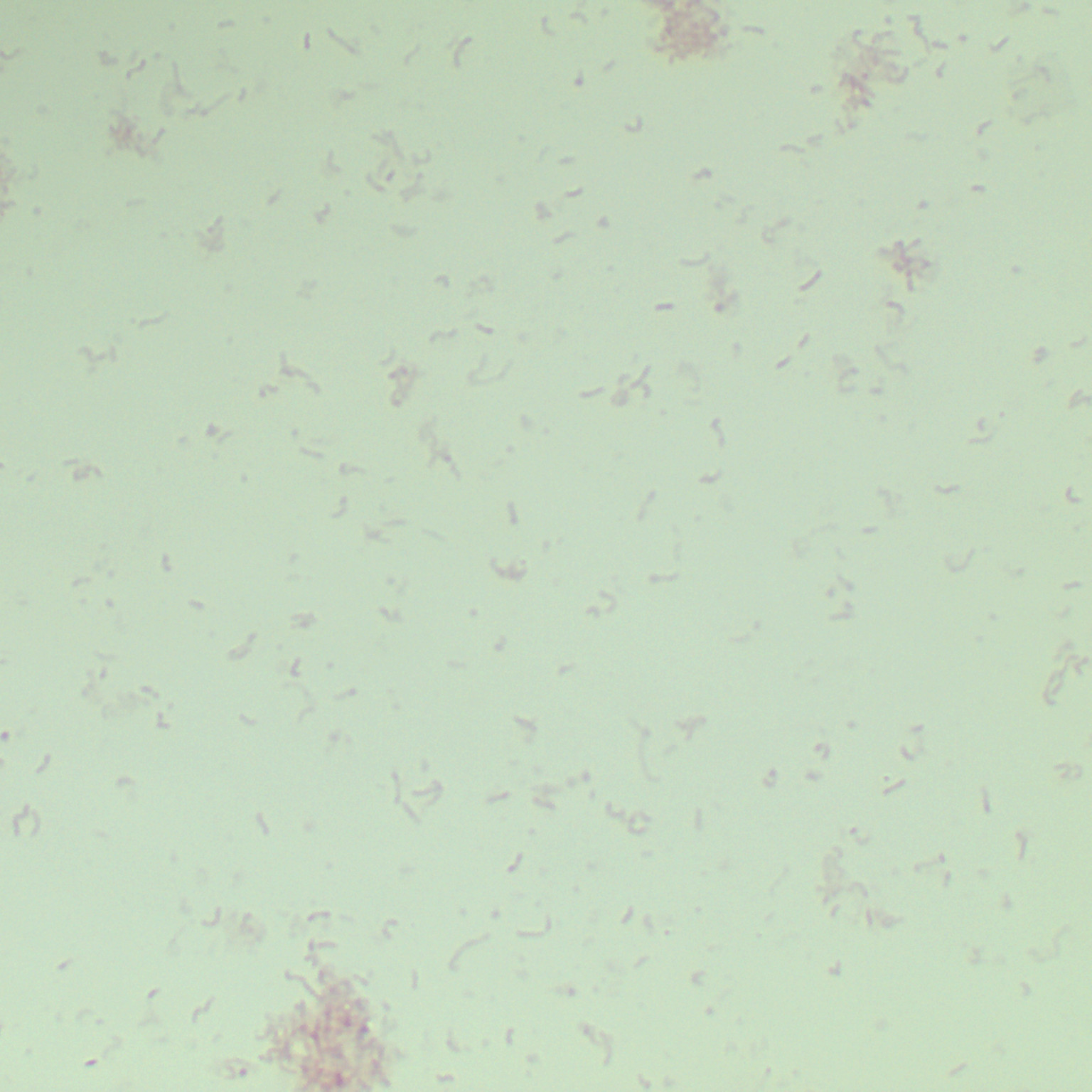 Alistipes senegalensis-BNCC