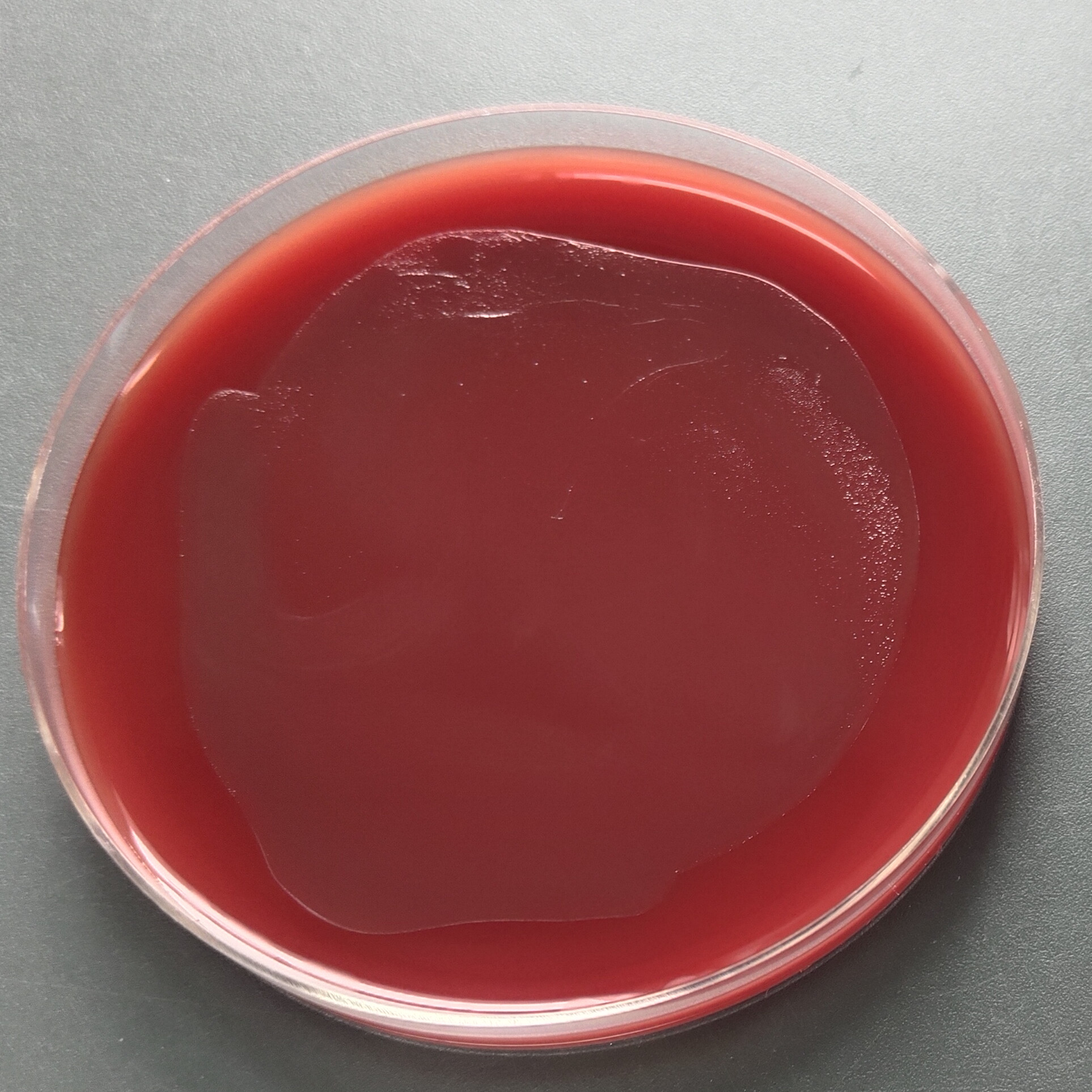 Helicobacter pylori-BNCC
