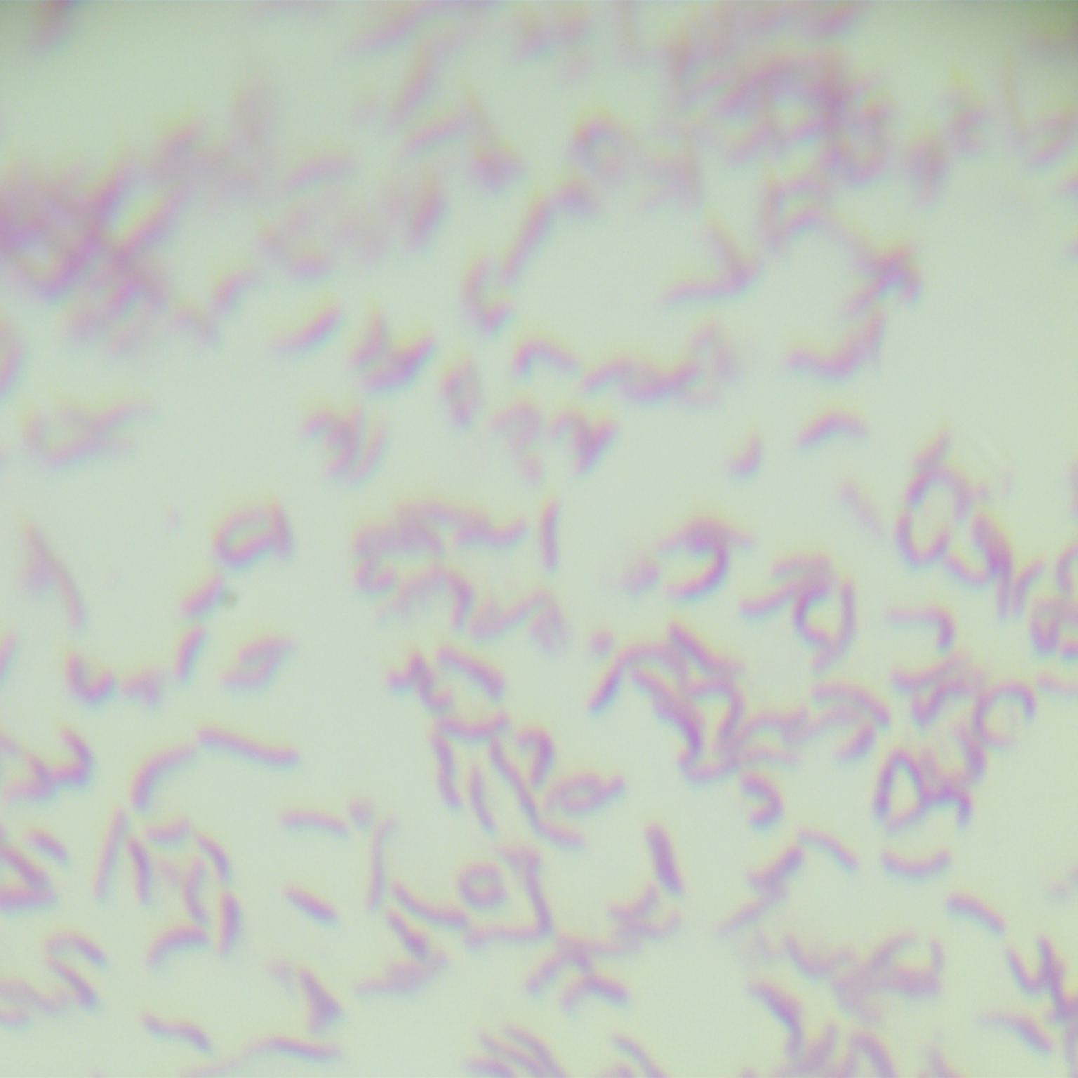 Helicobacter pylori-BNCC