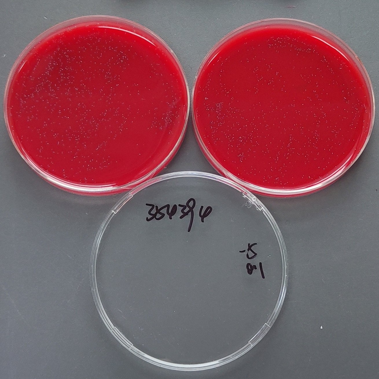 Streptococcus pharyngitis subsp. pharyngitis-BNCC