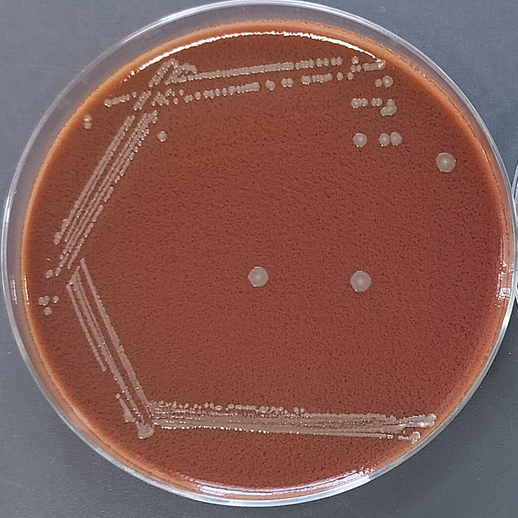 Actinobacillus pleuropneumoniae-BNCC