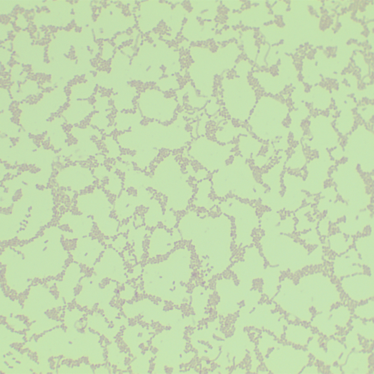 Actinobacillus pleuropneumoniae-BNCC