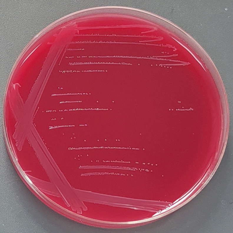 Fecal Segataceae-BNCC