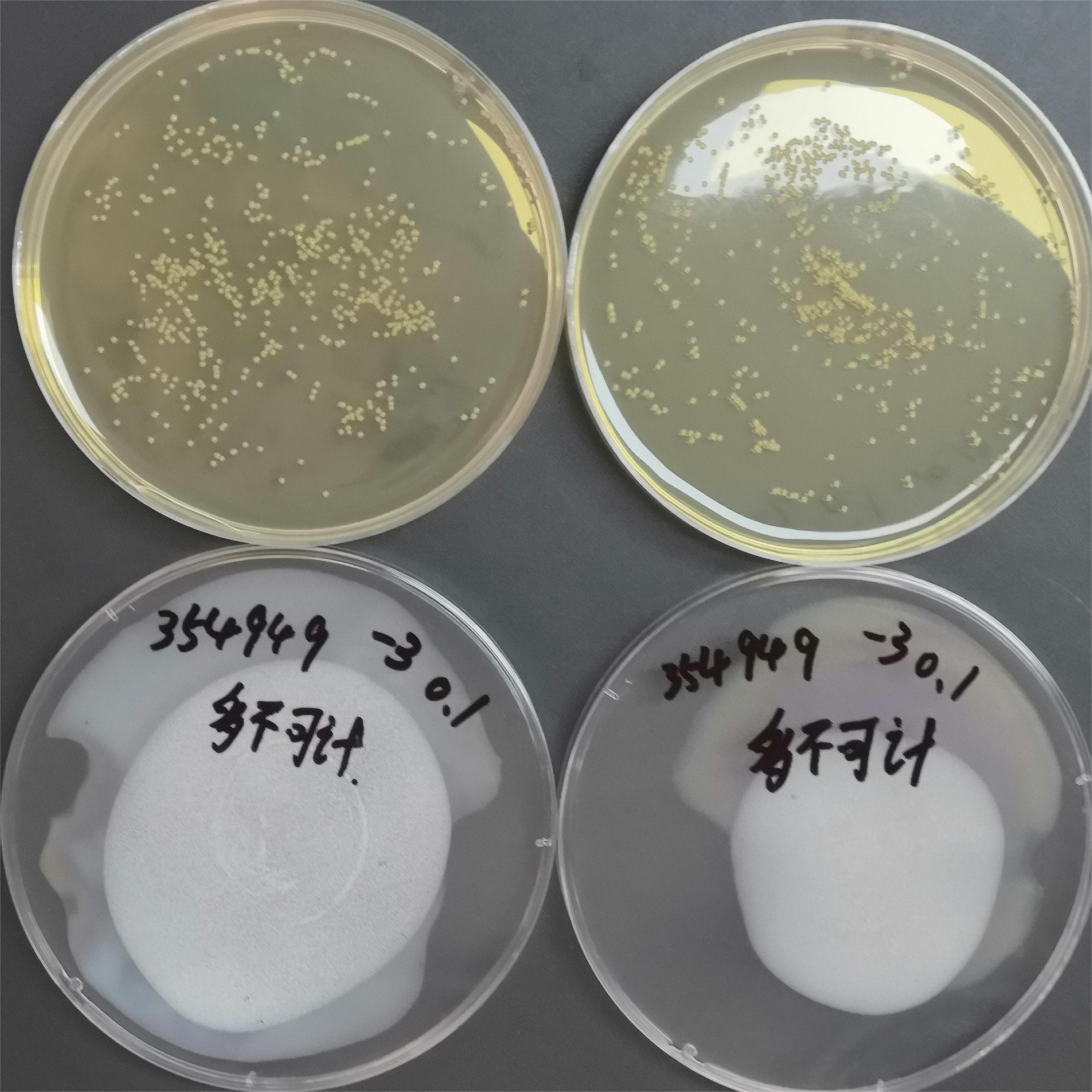 Quantitative strains of Corynebacterium casei-BNCC