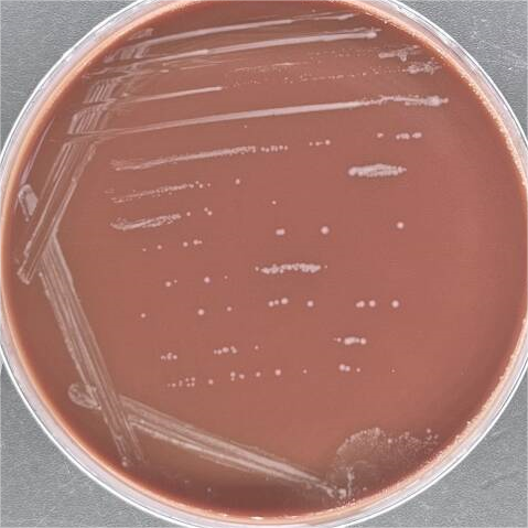 Bordetella holmesii-BNCC