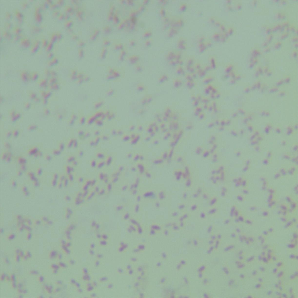 Bordetella holmesii-BNCC