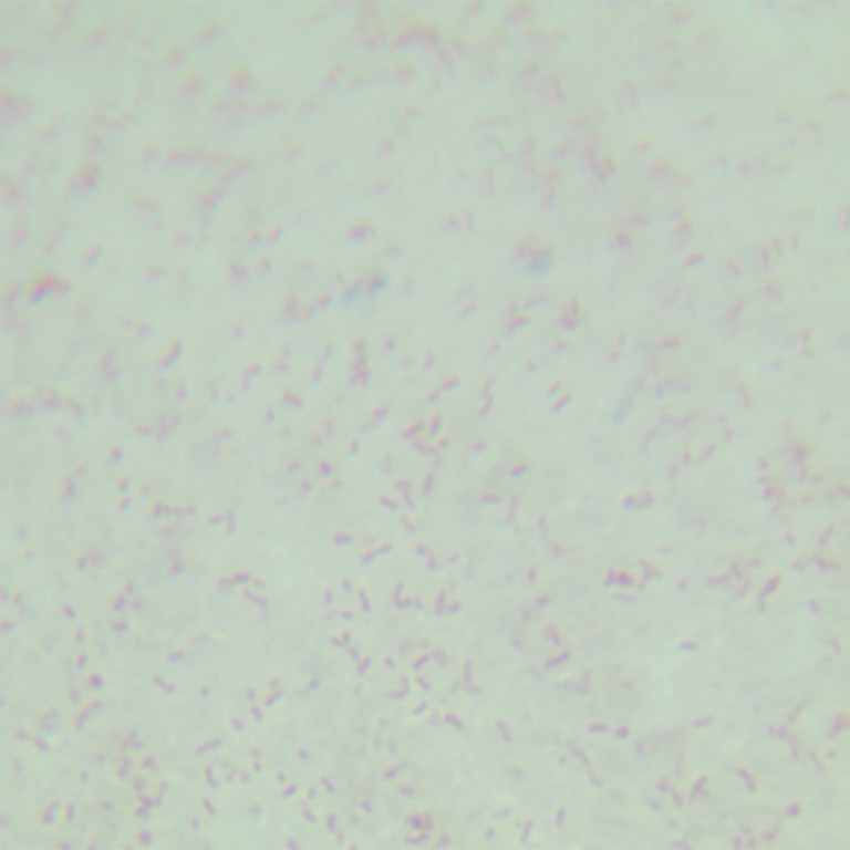 Vibrio cholerae-BNCC