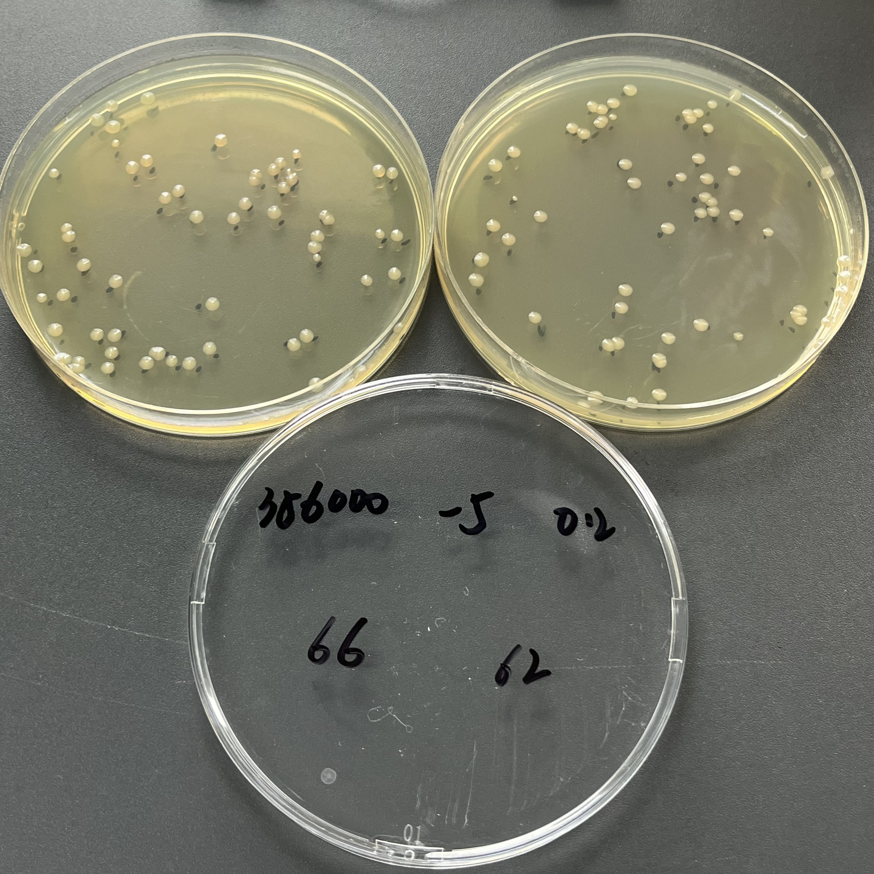 Quantitative strain of Escherichia coli-BNCC