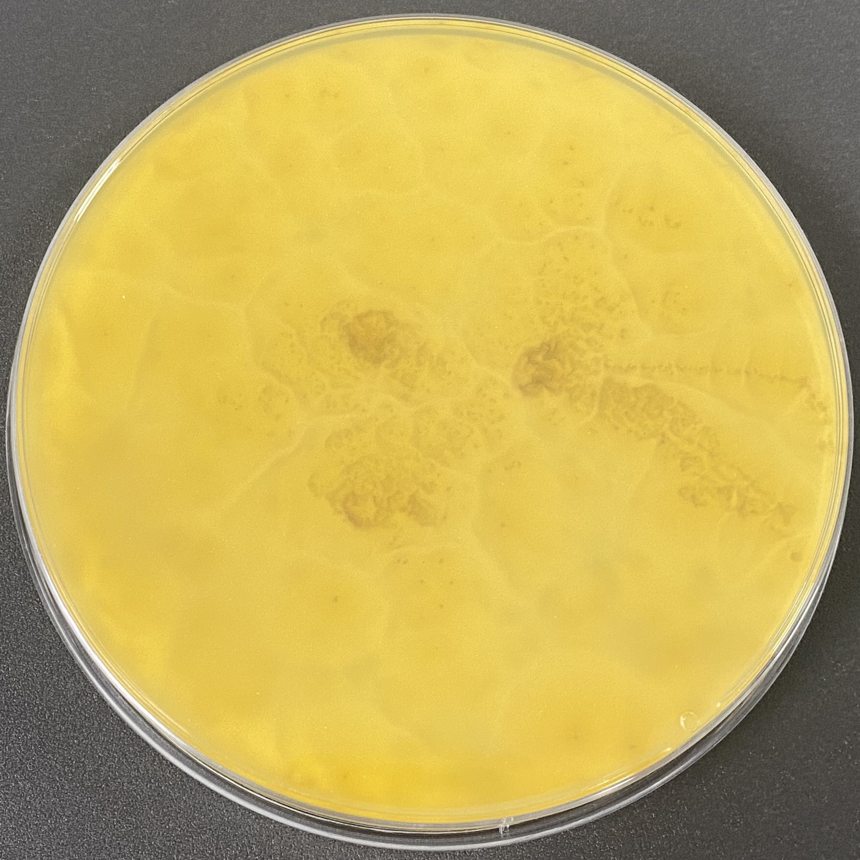 Aspergillus fumigatus-BNCC