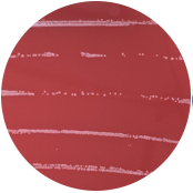 Listeria monocytogenes-BNCC