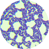 Listeria monocytogenes-BNCC