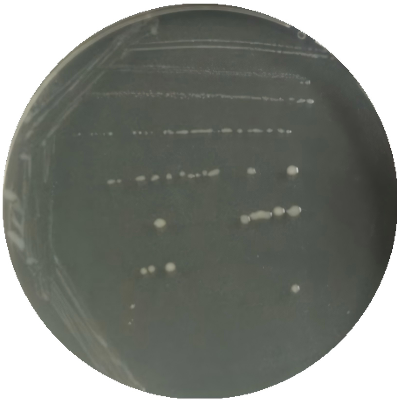 Magellan's Bacteroidetes Magninis subspecies-BNCC