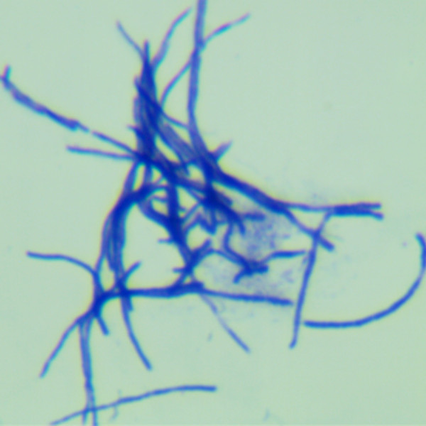 Head shaped Streptomyces-BNCC