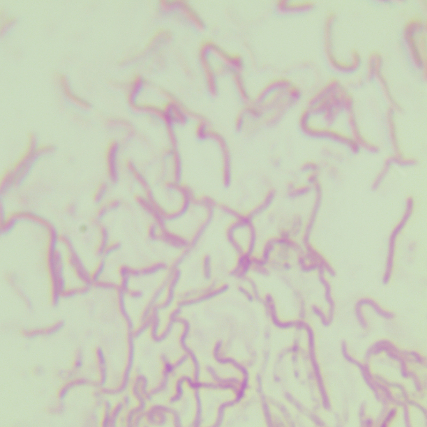 Escherichia coli-BNCC
