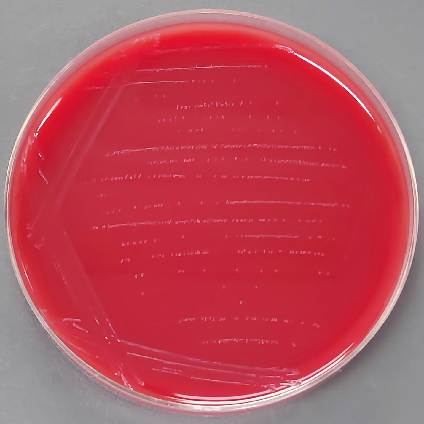 Helicobacter pylori-BNCC