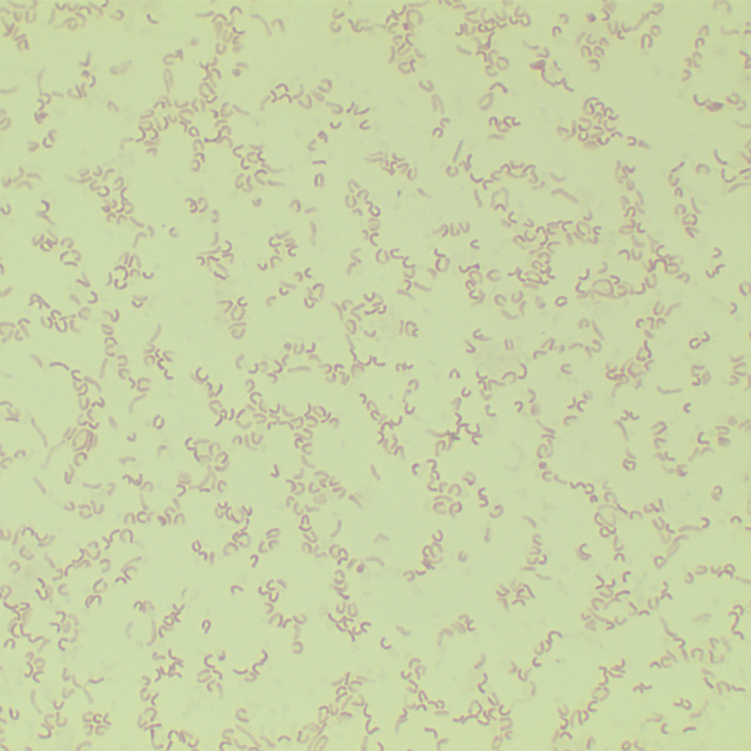 Helicobacter pylori-BNCC