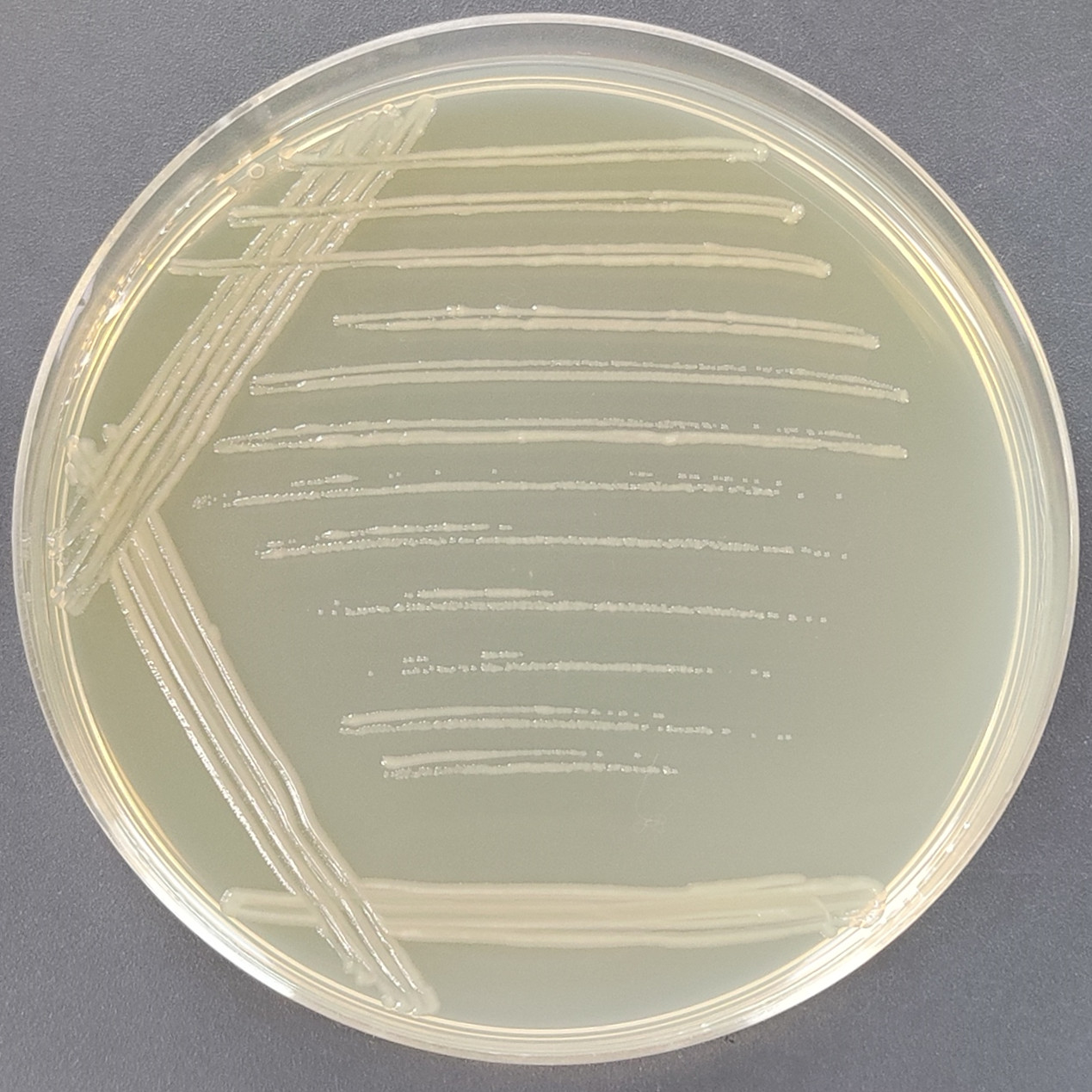 TOP10 Escherichia coli containing B646L gene in pet-20b (+) plasmid-BNCC