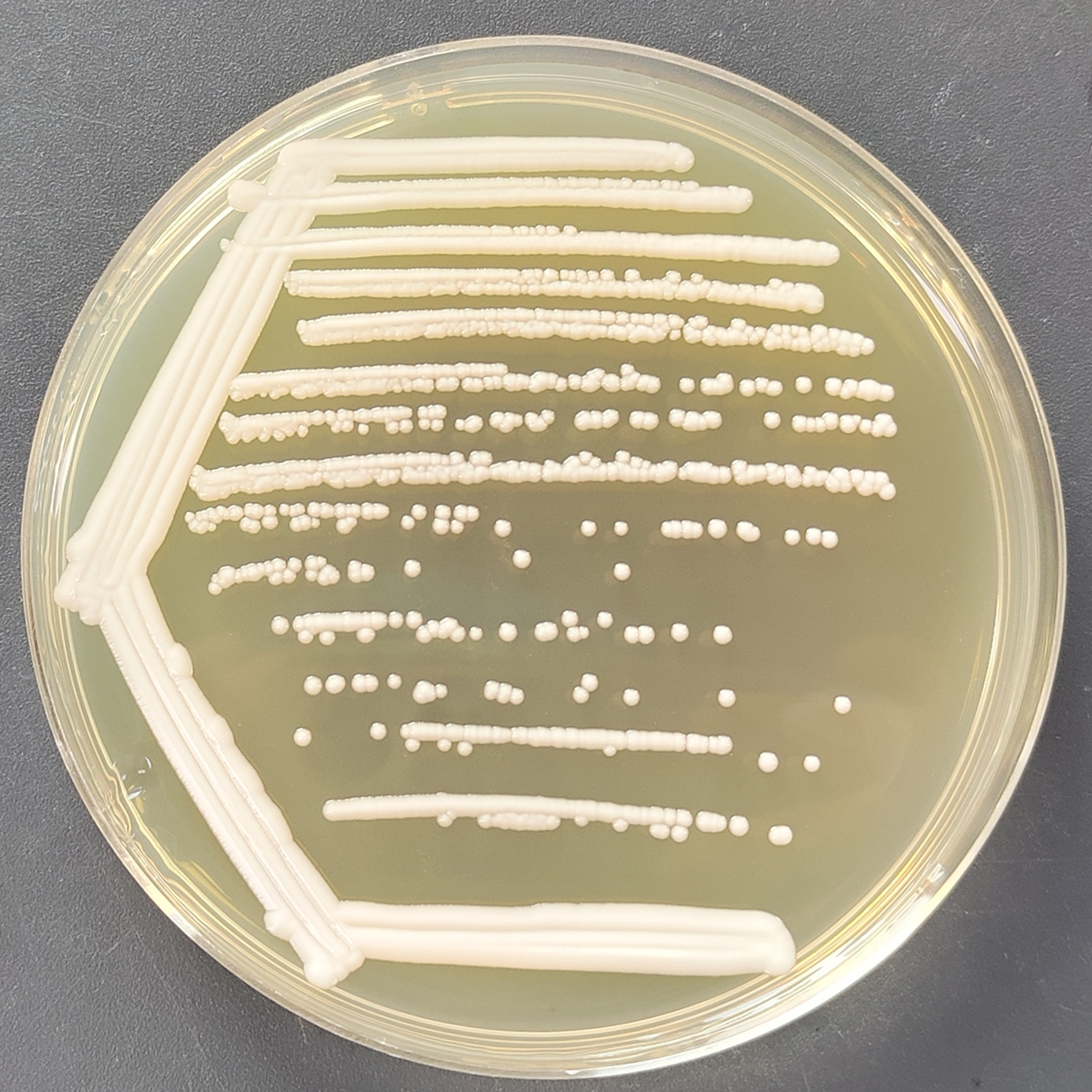 Candida auris-BNCC