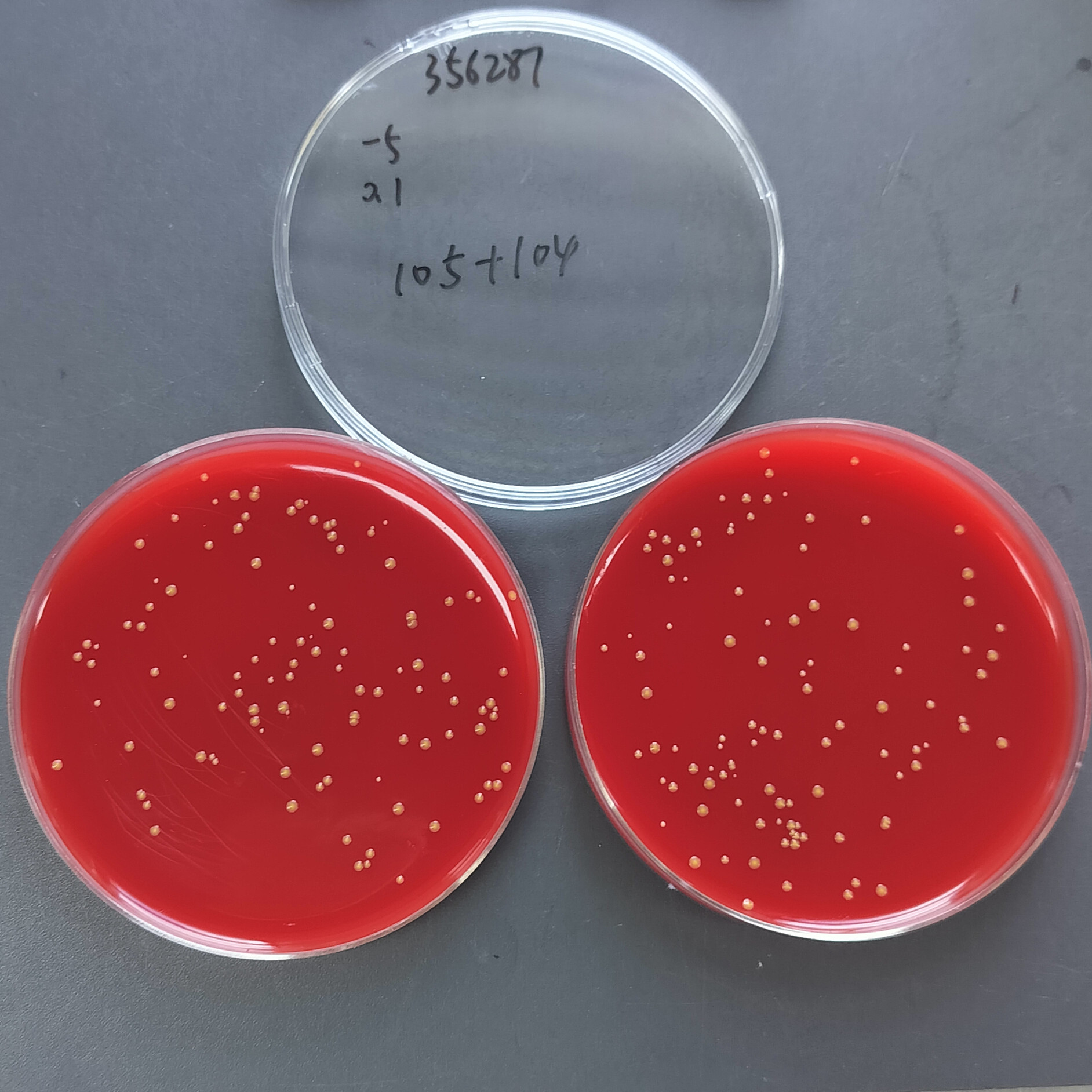 Slightly yellow Neisseria bacteria-BNCC