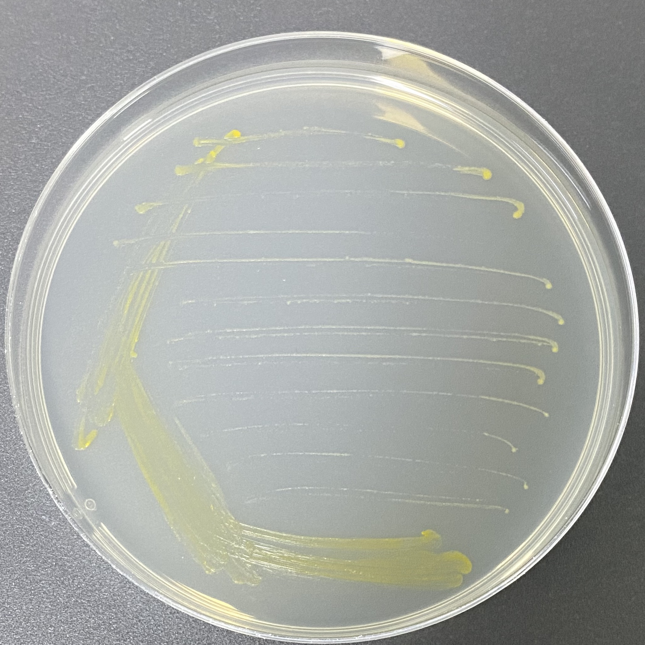 Aarhus harbor mycobacteria-BNCC