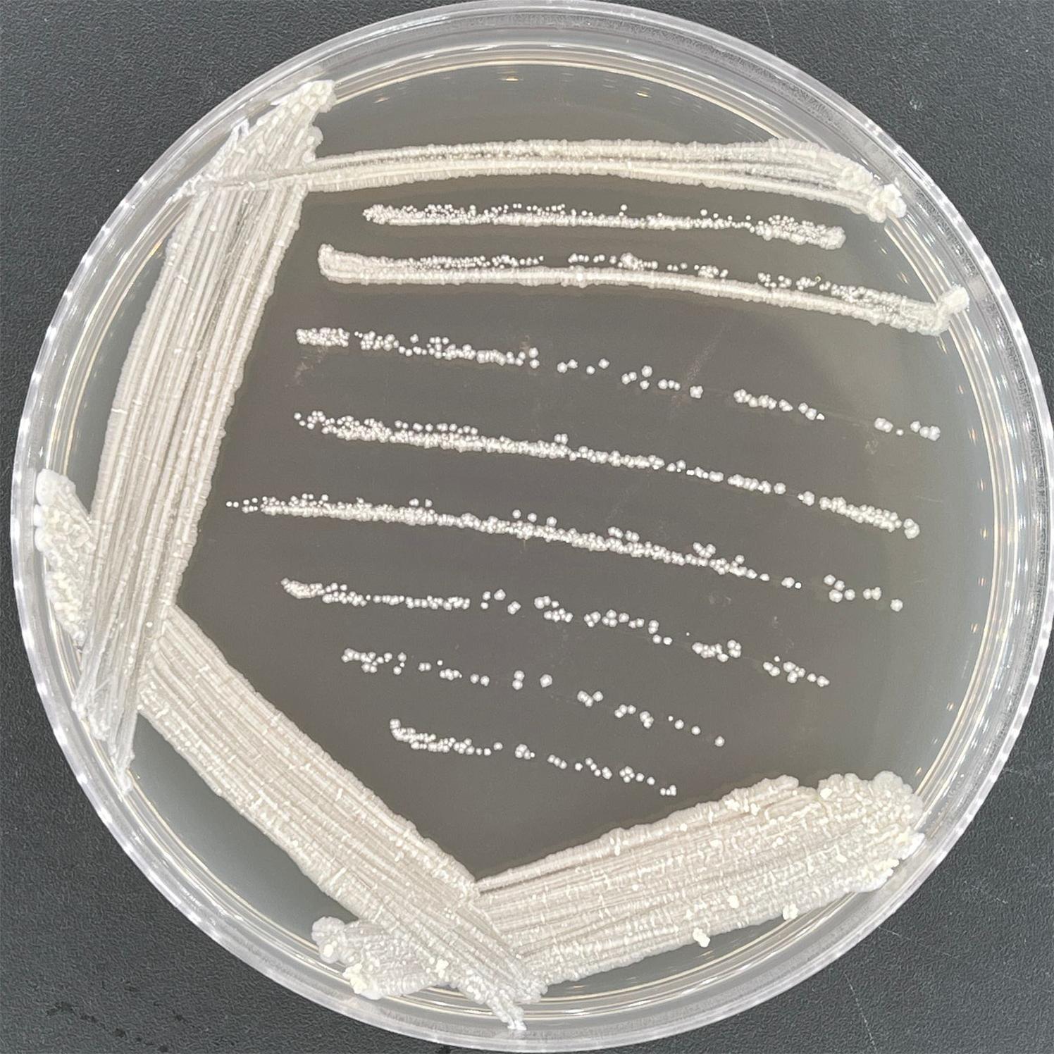Mycobacterium bovis-BNCC
