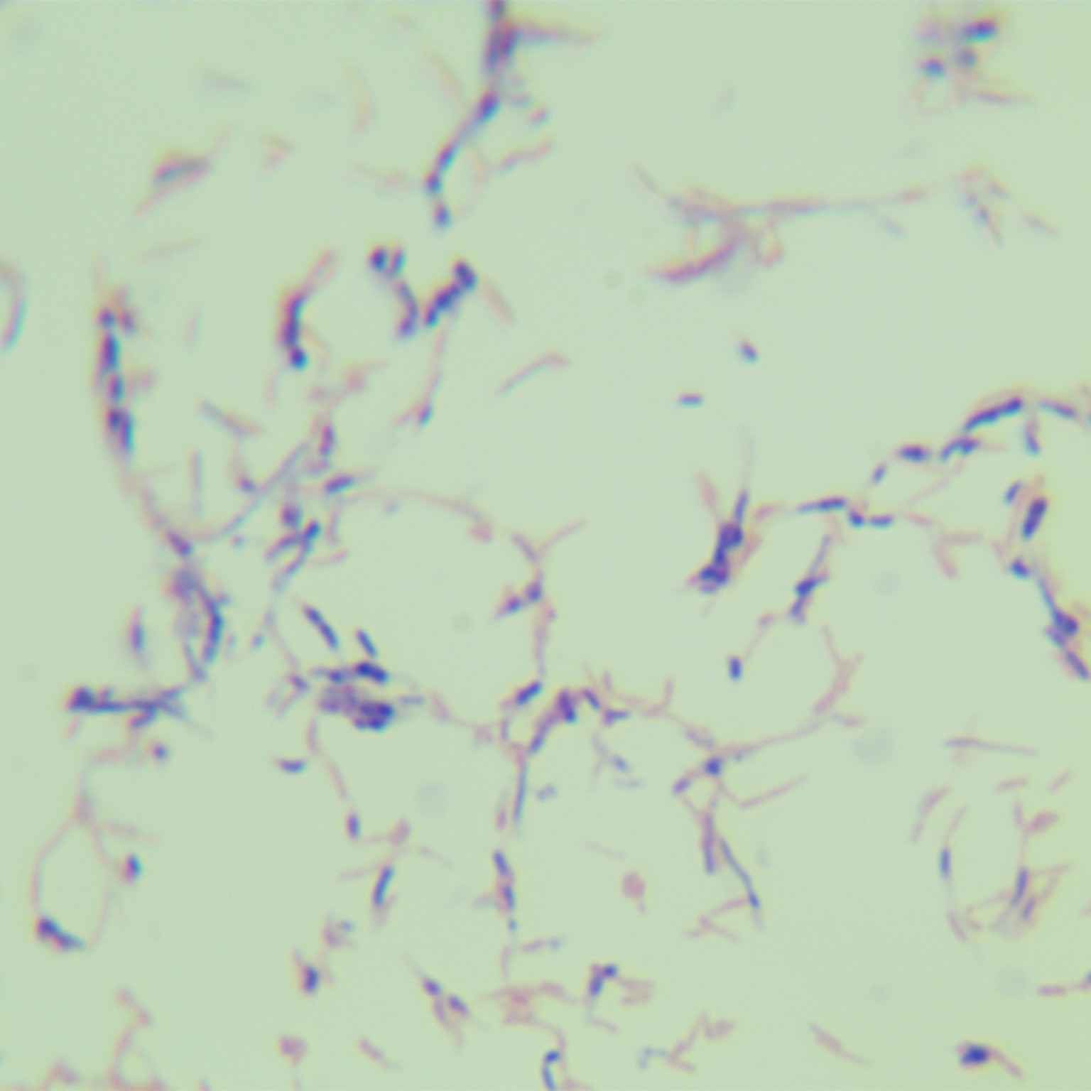 Mycobacterium delbrueckii-BNCC