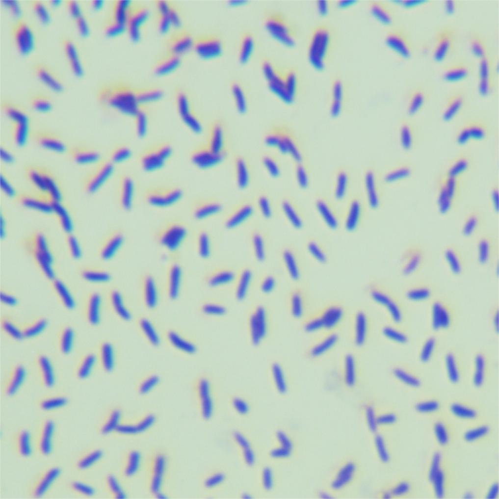 Brisbane Mycobacterium-BNCC