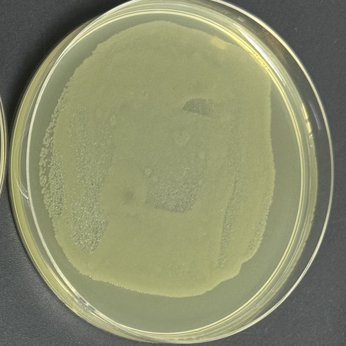 Escherichia coli C43 (DE3) pLysS-BNCC
