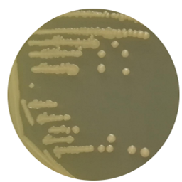 Escherichia coli-BNCC