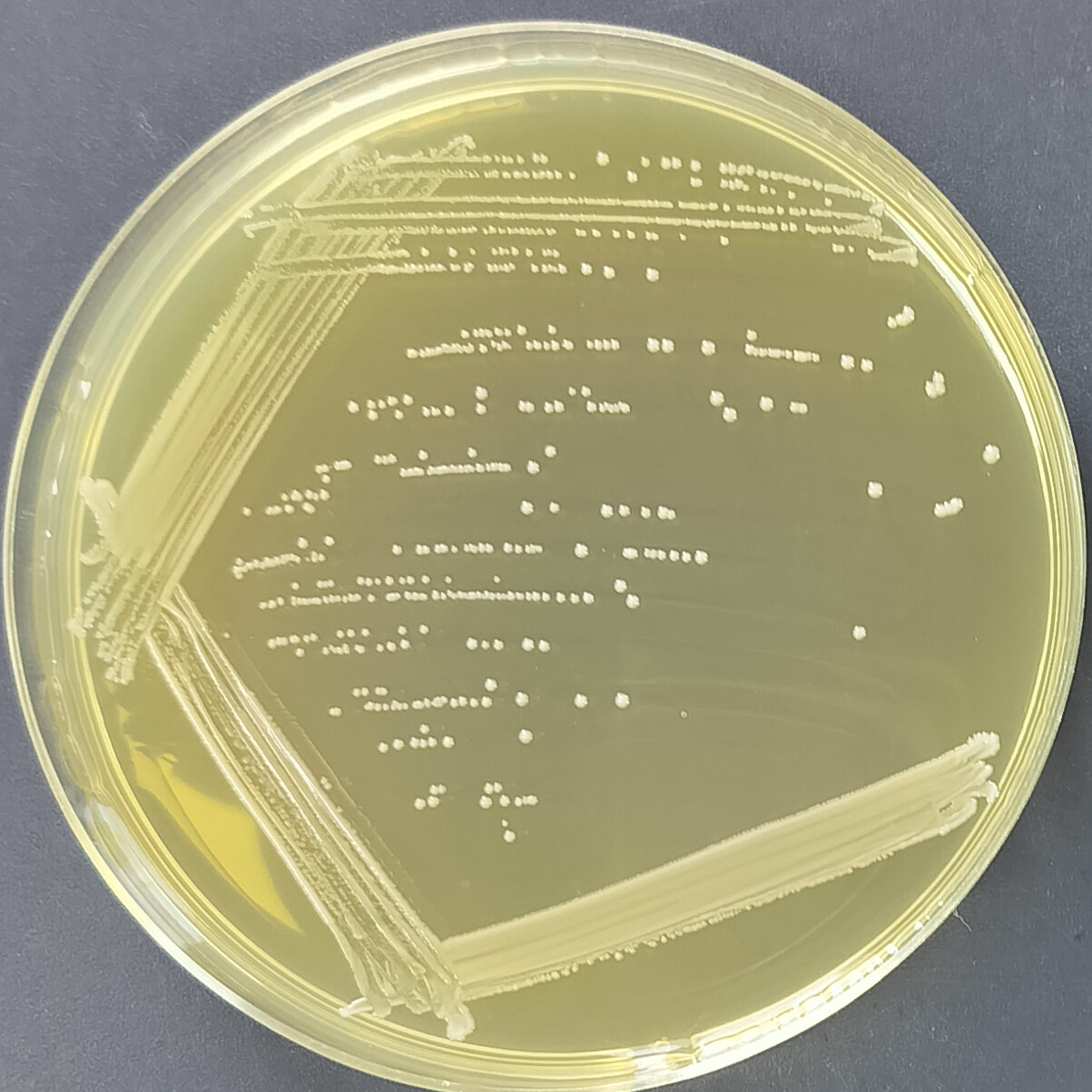 Streptococcus agalactiae-BNCC