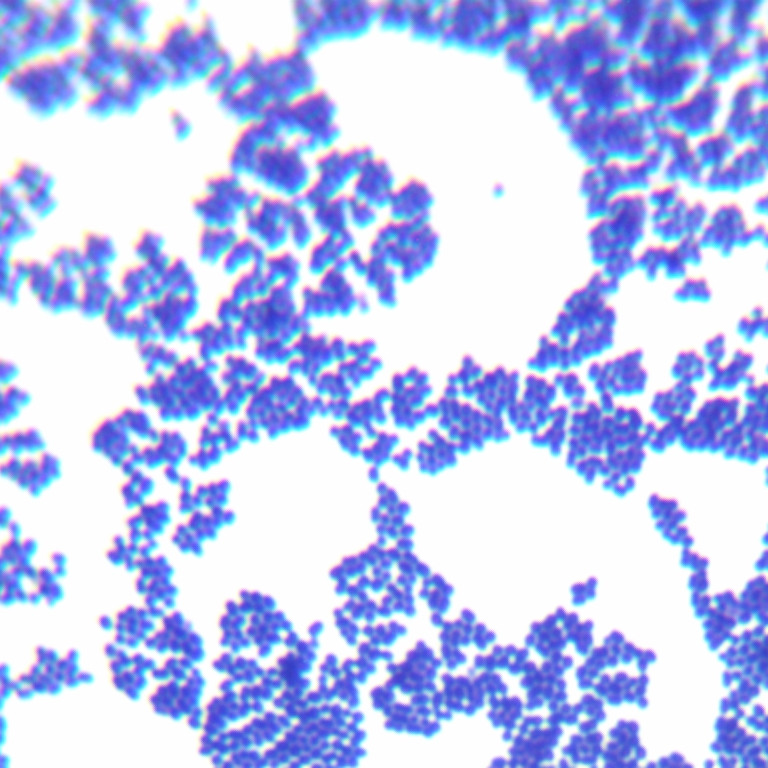 Streptococcus agalactiae-BNCC
